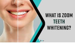 Considering Getting Zoom Teeth Whitening, You Must Watch This Video
