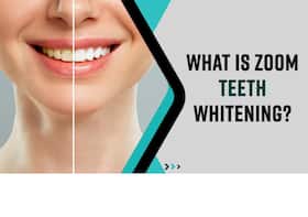 Considering Getting Zoom Teeth Whitening, You Must Watch This Video
