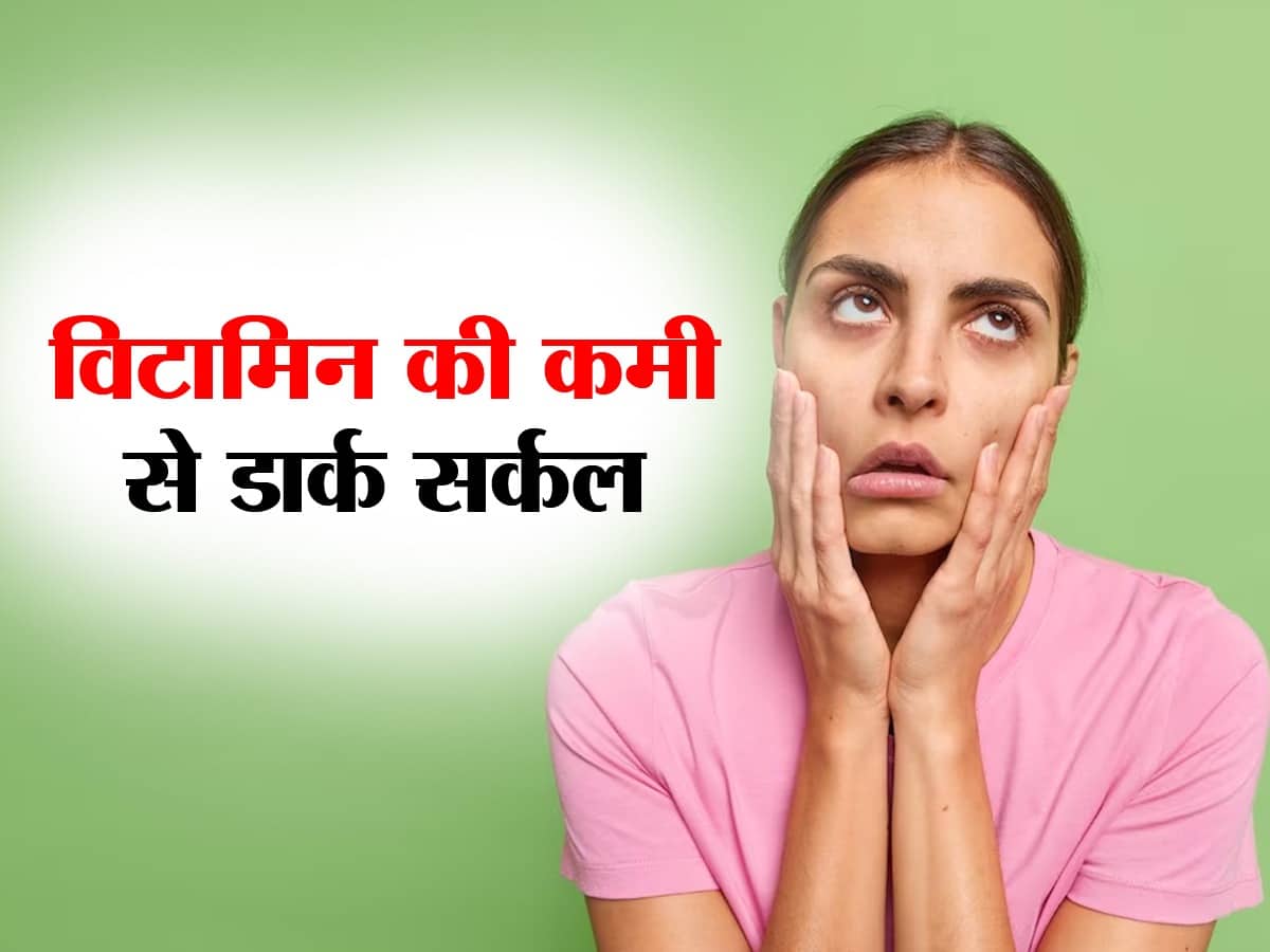 Vitamin Deficiency Causes Dark Circles In Hindi Vitamin की कमी से