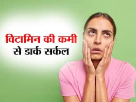 किस Vitamin की कमी से बनते हैं आंखों के काले घेरे (डार्क सर्कल), जानिए विटामिन और उसके वेजीटेरियन सोर्स
