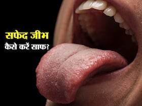 सफेद जीभ की वजह से लोगों के सामने होना पड़ सकता है शर्मिंदा, इन 5 नुस्खों से Oral Hygiene का रखें ध्यान