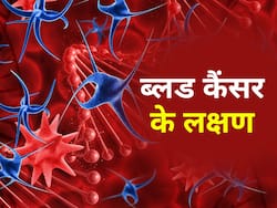 World Cancer Day 2023: नाक से खून निकलना खून के कैंसर (Leukemia) का है संकेत, जानिए ल्यूकेमिया के बारे में सबकुछ