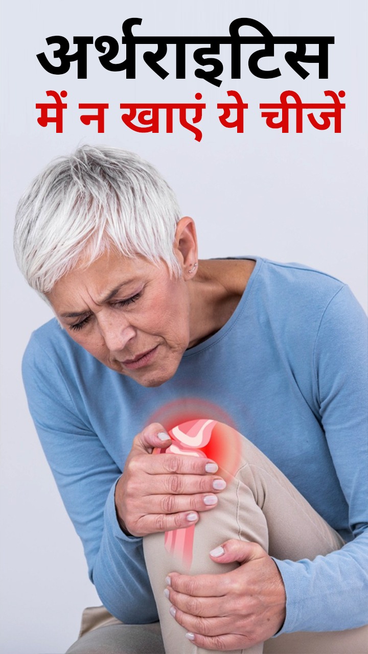 अर्थराइटिस के मरीज भूलकर भी न करें इन 9 चीजों का सेवन