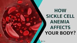 Sickle Cell Anemia: What Is Sickle Cell Anemia, That Indians Plan To Eliminate By 2047, Watch Video