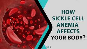 Sickle Cell Anemia: What Is Sickle Cell Anemia, That Indians Plan To Eliminate By 2047, Watch Video