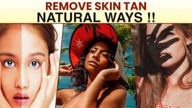 Skin Tanning: How To Get Rid Of Sun Tan In Summers Naturally, Watch Video