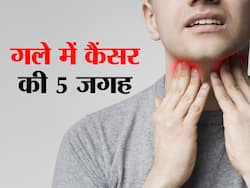 गले में कैंसर की 5 छिपी हुई जगह! जानें गले में किस जगह कैंसर होने पर दिखता है कौन सा लक्षण