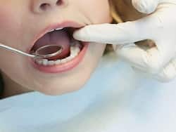 Enamel Damage In Children: 5 Oral Hygiene Practice That Every Parent Must Implement And More