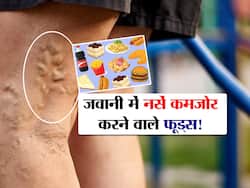 जवानी में नसों को कमजोर बनाने का काम करते हैं 5 फूड्स! जानें हाथ-पैर की नसों को कमजोर करने वाले अनहेल्दी फूड्स