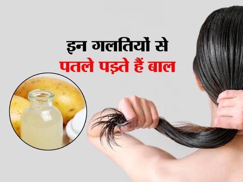इन 3 गलतियों की वजह से पतले पड़ रहे आपके बाल, हेयर फॉल से बचना है तो इस चीज से बनाएं मजबूत हिंदी इन 3 गलतियों की वजह से पतले पड़ रहे आपके बाल, हेयर फॉल से बचना है तो इस चीज से बनाएं मजबूत हिंदी