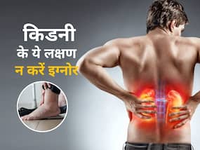 ये 3 साधारण लक्षण भी दिखें तो समझ लें किडनी होने लगी है डैमेज, आज ही खाना शुरू करें ये हेल्दी फूड्स ये 3 साधारण लक्षण भी दिखें तो समझ लें किडनी होने लगी है डैमेज, आज ही खाना शुरू करें ये हेल्दी फूड्स