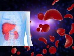 किडनी और लिवर को डैमेज कर सकता है सिकल सेल एनीमिया, जानें लक्षण महसूस होने पर क्या करना चाहिए