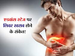 पेट से जुड़ी ये 4 परेशानियां बताती हैं आ गई फैटी लिवर की एडवांस स्टेज! इस तरह पहचानें लिवर के खराब होने के संकेत