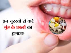 मुंह के छाले की वजह से खाना-पीना हो गया है दुभर, तुरंत छुटकारा पाने के लिए इस्तेमाल करें ये घर की चीजें