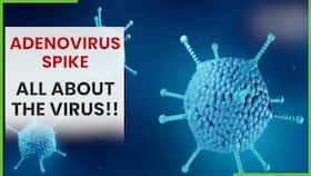 Adenovirus In West Bengal: Spike In The Cases Suspected Infection, Know The Symptoms, Watch Video