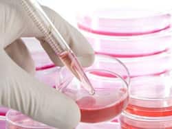 5 Benefits Of Stem Cells Banking: Here   s Why You Need To Seriously Consider It