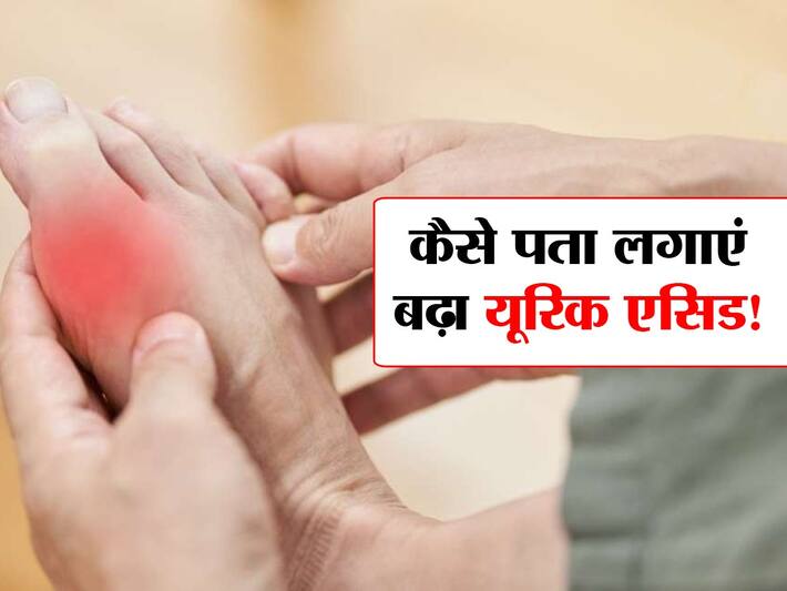 How to check Uric acid शरीर में इस एसिड की मात्रा बढ़ने से खराब होने