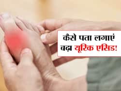 शरीर में इस एसिड की मात्रा बढ़ने से खराब होने लगते हैं ये 4 अंग! जानें किस एसिड को कंट्रोल करना है जरूरी