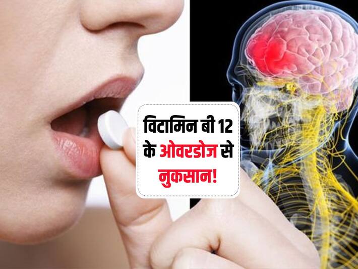 Overdose of Vitamin B12 Vitamin B12 का ओवरडोज लेने से होती है ये 8