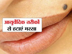 तिल और मस्से से चेहरे की खूबसूरती होने लगती है खराब, आयुर्वेद के इन नुस्खों से तुरंत पाएं छुटकारा