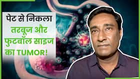 आदमी के पेट से निकाले तरबूज और Football Size के Tumor, जानें पूरा मामला