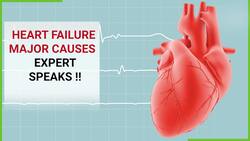 Major Causes Of Heart Failure Defined By Expert