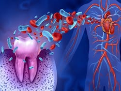 Bacteria In Your Mouth Can Block Your Heart Arteries, Cause Severe Lung Infection: Doctor Explains How