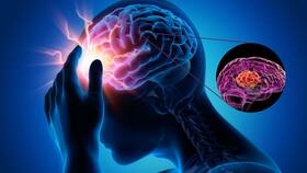 Can Chronic Migraine Lead To Long-Term Brain Damage