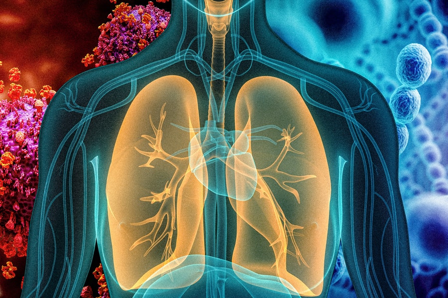 COVID-19 Pneumonia: How Long Does It Take To Recover Completely?