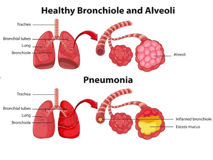 do-we-need-to-see-a-doctor-for-a-common-cold-thehealthsite