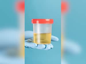 Urine Colour: Here's What Its Telling You About Your Health