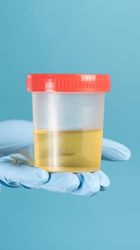 Urine Colour: Here's What Its Telling You About Your Health
