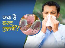गर्मियों में बढ़ जाती है डस्ट एलर्जी, एक्सपर्ट से जानिए लक्षण और बचाव के टिप्स