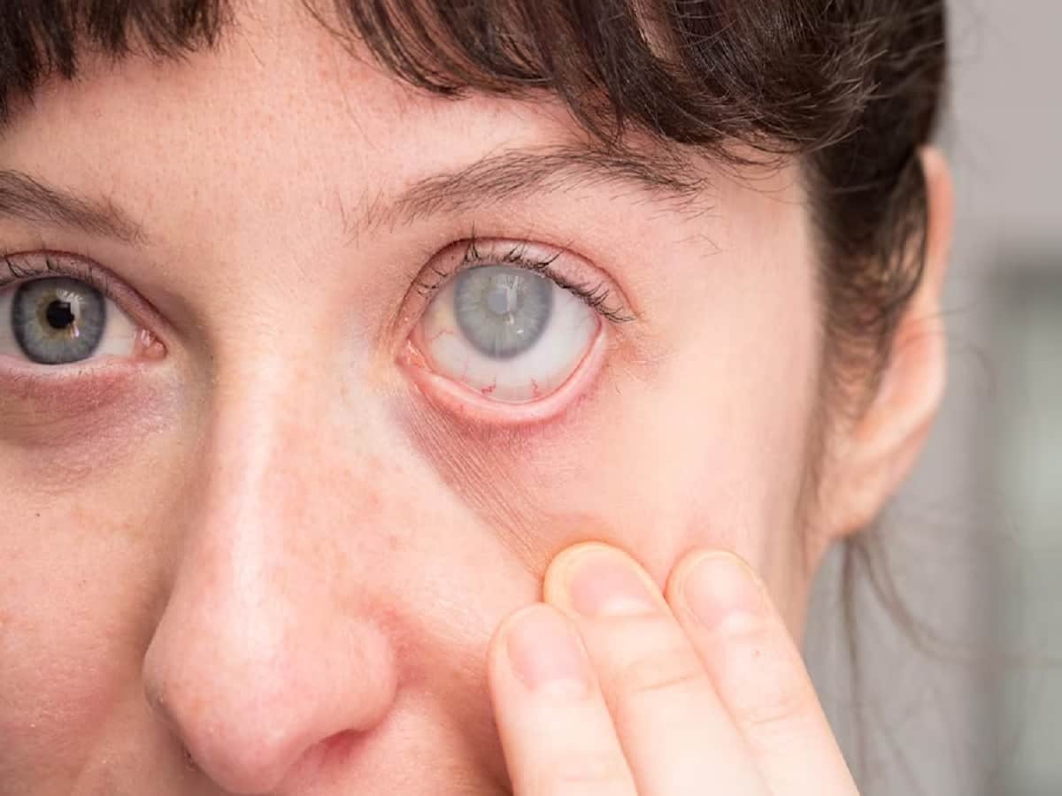 Can Eye Diseases Be Treated With Ayurveda?