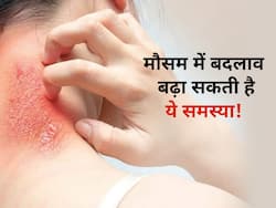 मौसम में आए अचानक बदलाव से बढ़ रहा है फंगल इन्फेक्शन का अटैक, इन नैचुरल उपायों से पाएं राहत
