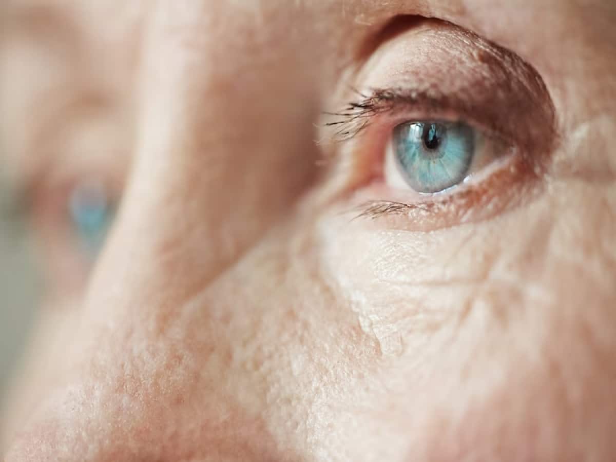 Did you know glaucoma is the second leading cause of blindness after cataracts?