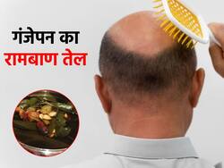 किचन में रखी इन 2 चीजों से बनाएं ये खास ऑयल, इस तरह तैयार करें गंजेपन का रामबाण तेल 