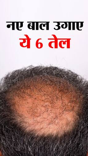 Oils for Hair Regrowth :  बालों को दोबारा उगाए ये 6 खास तेल