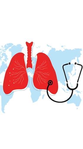 World Tuberculosis Day 2023: These 8 Could Be TB Signs
