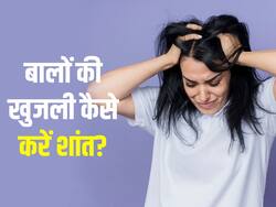 स्कैल्प को खुजला-खुजला कर हो गए हैं परेशान? 2 रुपये की इस चीज से खुजली से तुरंत पाएं आराम