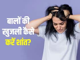 स्कैल्प को खुजला-खुजला कर हो गए हैं परेशान? 2 रुपये की इस चीज से खुजली से तुरंत पाएं आराम स्कैल्प को खुजला-खुजला कर हो गए हैं परेशान? 2 रुपये की इस चीज से खुजली से तुरंत पाएं आराम