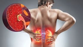 H3N2 Influenza Virus: 3 Severe Side Effects On The Kidney