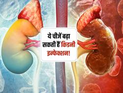 खाने की ये 5 चीजें बढ़ा सकती हैं किडनी इन्फेक्शन की परेशानी, आज ही बना लें दूरी
