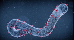 Marburg Virus In Africa: 7 Unusual Symptoms of This Ebola-Like Virus You Must Know