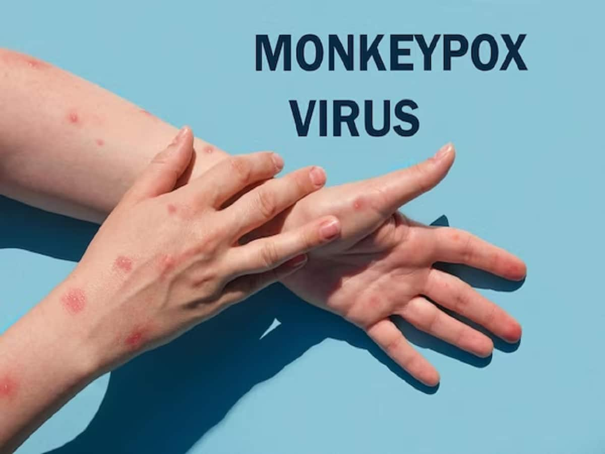 Antibiotic Nitroxoline May Help Fight Mpox Or Monkeypox | TheHealthSite.com