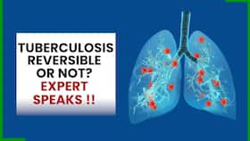Tuberculosis Treatment: How TB Patient's Health Can Become Better, Expert Speaks, Watch Video