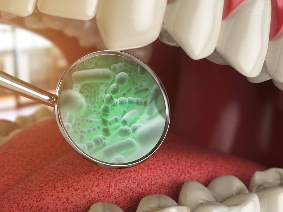 Pneumonia To Arthritis 10 Unusual Health Issues Bad Oral Health Can