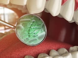 Pneumonia To Arthritis: 10 Unusual Health Issues Bad Oral Health Can Cause