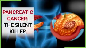 Pancreatic Cancer: Doctor Explains 7 Unusual Symptoms of This Silent Killer Pancreatic Cancer: Doctor Explains 7 Unusual Symptoms of This Silent Killer