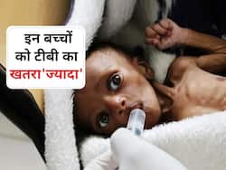 कुपोषित और कमजोर बच्चों में ज्यादा होता है टीबी! माता-पिता कमजोर बच्चों में टीबी को रोकने के लिए करें ये काम